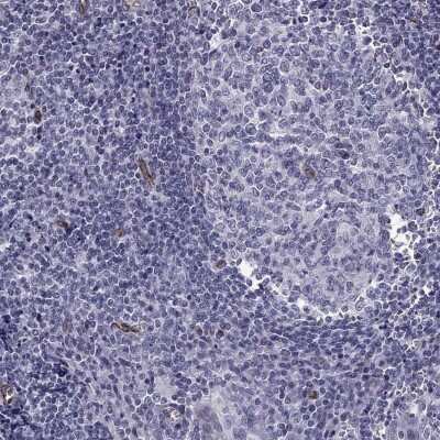 Immunohistochemistry-Paraffin: ANKS4B Antibody [NBP3-17132]