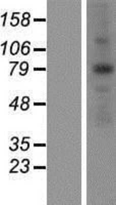 Western Blot: ANKZF1 Overexpression Lysate [NBP2-06878]