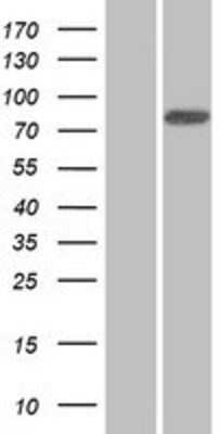 Western Blot: ANKZF1 Overexpression Lysate [NBP2-08359]