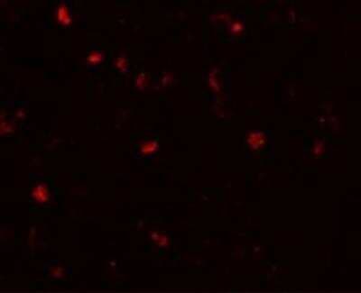 Immunocytochemistry/ Immunofluorescence: ANO2 Antibody - BSA Free [NBP2-81703]