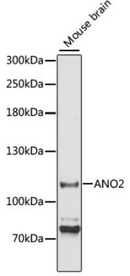 Immunohistochemistry-Paraffin: ANO2 Antibody - Azide and BSA Free [NBP2-92888]