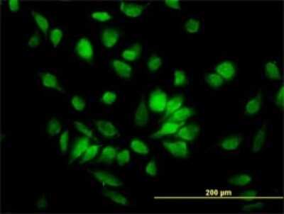 Immunocytochemistry/ Immunofluorescence: ANP32A Antibody (2G11-4A5) [H00008125-M01]