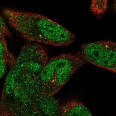Immunocytochemistry/ Immunofluorescence: ANP32A Antibody [NBP2-49385]