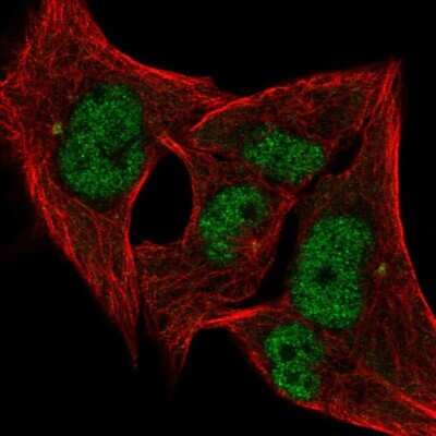 Immunocytochemistry/ Immunofluorescence: ANP32A Antibody [NBP2-49519]