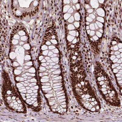Immunohistochemistry-Paraffin: ANP32A Antibody [NBP2-49385]