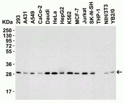 Western Blot: ANP32A AntibodyBSA Free [NBP2-81794]