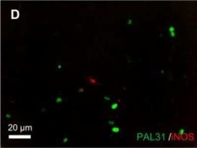 Immunocytochemistry/ Immunofluorescence: ANP32B Antibody [NB100-1199]