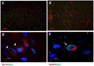 Immunohistochemistry: ANP32B Antibody [NB100-1199]