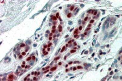Immunohistochemistry-Paraffin: ANP32B Antibody [NB100-1199]