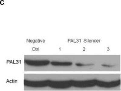 Knockdown Validated: ANP32B Antibody [NB100-1199]
