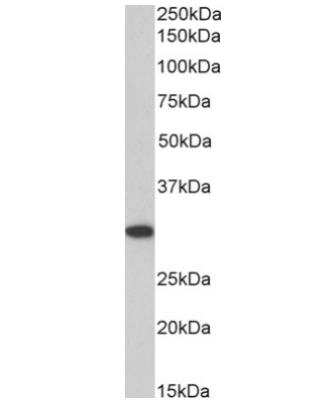 Western Blot: ANP32B Antibody [NB100-1199]
