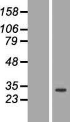 Western Blot: ANP32C Overexpression Lysate [NBP2-07449]