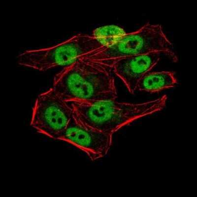 Immunocytochemistry/ Immunofluorescence: AOF1 Antibody (5E10C1) - BSA Free [NBP2-52415]