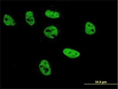 Immunocytochemistry/ Immunofluorescence: AP-2 beta/TFAP2B Antibody (2F6) [H00007021-M02]