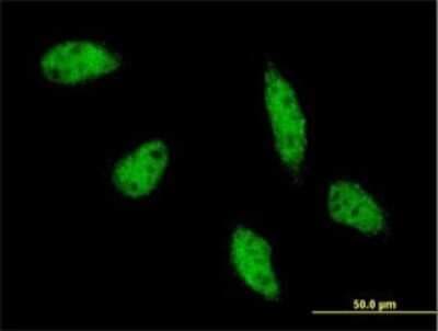 Immunocytochemistry/ Immunofluorescence: AP-2 beta/TFAP2B Antibody (3G5-1D11) [H00007021-M01]
