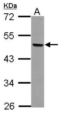 Western Blot: AP-2 beta/TFAP2B Antibody [NBP2-20606]