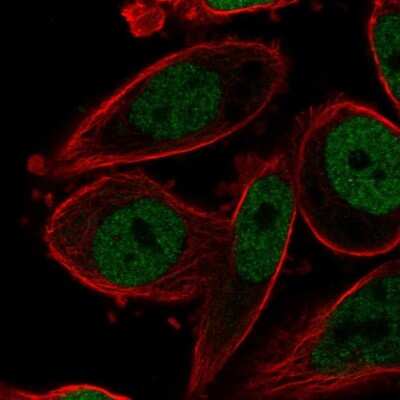 Immunocytochemistry/ Immunofluorescence: AP-2 gamma Antibody [NBP2-49170]