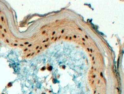 Immunohistochemistry-Paraffin: AP-2 gamma Antibody [NB100-1516]