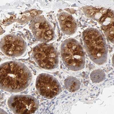 Immunohistochemistry-Paraffin: AP1G2 Antibody [NBP1-81857]