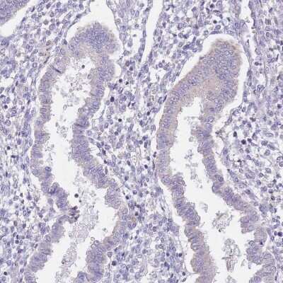 Immunohistochemistry-Paraffin: AP1S2 Antibody [NBP2-14299]