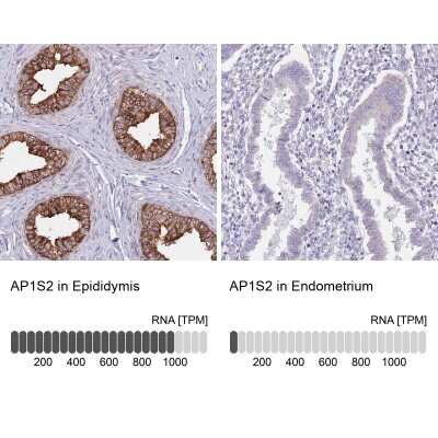 Immunohistochemistry-Paraffin: AP1S2 Antibody [NBP2-14299]