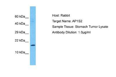 Western Blot: AP1S2 Antibody [NBP2-87010]