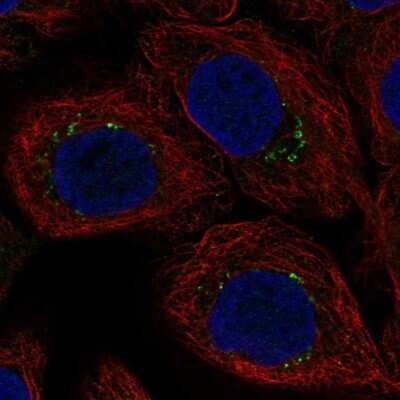 Immunocytochemistry/ Immunofluorescence: AP1S3 Antibody [NBP2-49493]