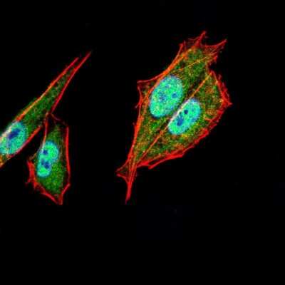 Immunocytochemistry/ Immunofluorescence: AP2 alpha Antibody (1A10C5) - BSA Free [NBP2-52571]