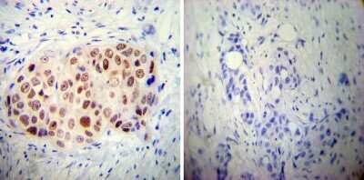 Immunohistochemistry-Paraffin: AP2 alpha Antibody (3B5) [NB100-74359]