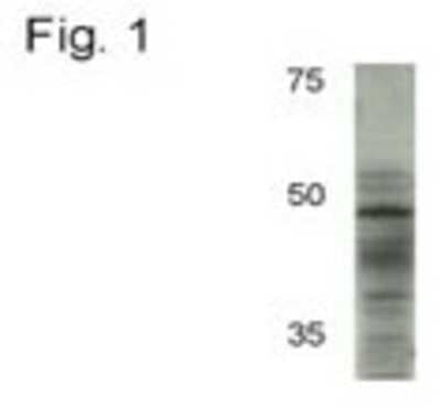 Western Blot: AP2 alpha Antibody (3B5) [NB100-74359]
