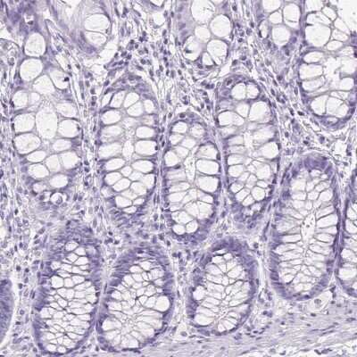 Immunohistochemistry-Paraffin: AP2 alpha Antibody [NBP2-38809]