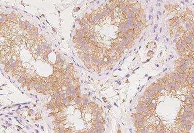 Immunohistochemistry-Paraffin: AP2A2 Antibody [NBP3-12692]