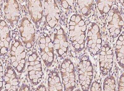 Immunohistochemistry-Paraffin: AP2A2 Antibody [NBP3-12692]