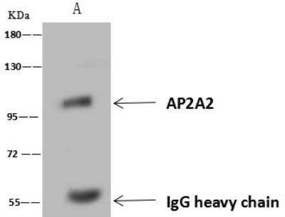 Immunoprecipitation: AP2A2 Antibody [NBP3-12692]
