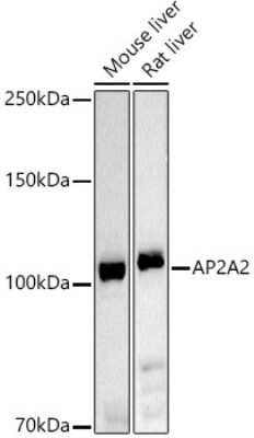 Western Blot: AP2A2 AntibodyAzide and BSA Free [NBP2-92458]