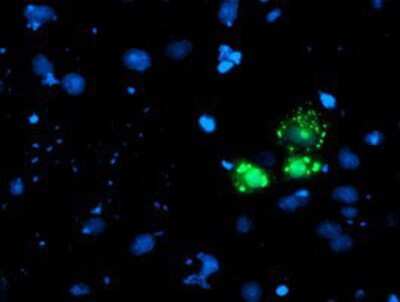 Immunocytochemistry/ Immunofluorescence: AP2M1 Antibody (OTI1E9) [NBP2-00834]