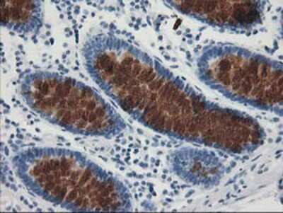 Immunohistochemistry-Paraffin: AP2M1 Antibody (OTI1E9) [NBP2-00834]