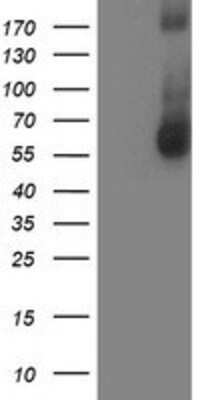 Western Blot: AP2M1 Antibody (OTI1E9) [NBP2-00834]
