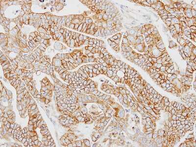 Immunohistochemistry-Paraffin: AP2M1 Antibody [NBP1-32272]