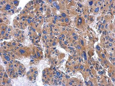 Immunohistochemistry-Paraffin: AP3M2 Antibody [NBP2-15419]
