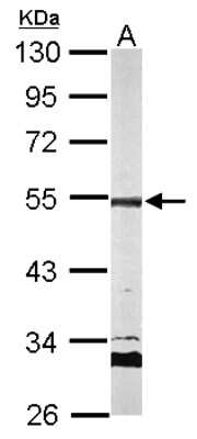 Western Blot: AP2M1 Antibody [NBP2-15418]