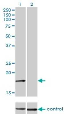 Western Blot: AP2S1 Antibody (3E4) [H00001175-M01]