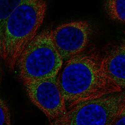 Immunocytochemistry/ Immunofluorescence: AP3D1 Antibody [NBP2-57286]