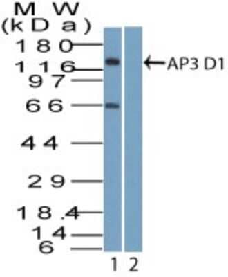 Western Blot: AP3D1 Antibody [NBP2-27158]