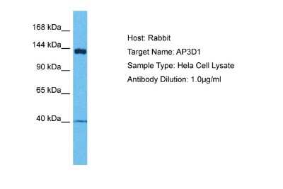Western Blot: AP3D1 Antibody [NBP2-84438]