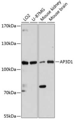 Western Blot: AP3D1 AntibodyAzide and BSA Free [NBP2-92046]
