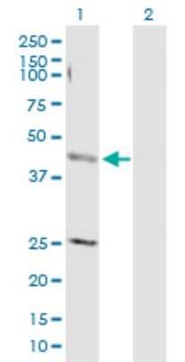 Western Blot: AP4M1 Antibody [H00009179-D01P]