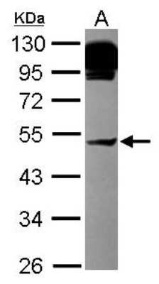 Western Blot: AP4M1 Antibody [NBP2-14874]