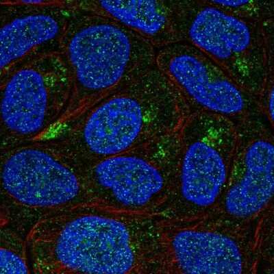 Immunocytochemistry/ Immunofluorescence: AP5B1 Antibody [NBP2-49531]