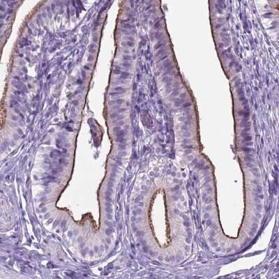 Immunohistochemistry-Paraffin: AP5B1 Antibody [NBP2-49460]